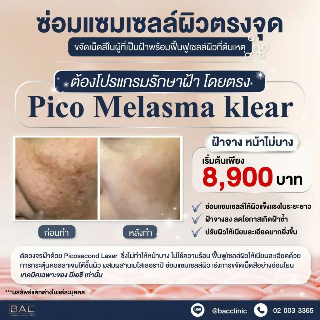 Pico Melasma Klear 